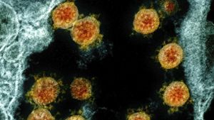 Farblich bearbeitete Partikel des Coronavirus SARS-CoV-2. Forscher stellten jetzt einen besonders extremen Fall einer Corona-Infektion vor. Foto: dpa/Uncredited