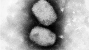 Diese vom Robert Koch-Institut (RKI) zur Verfügung gestellte elektronenmikroskopische Aufnahme zeigt das Affenpockenvirus. Foto: /RKI/dpa/Andrea Männel