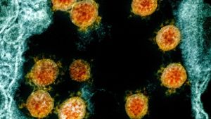 Elektronenmikroskopische Aufnahme des Coronavirus SARS-CoV-2. Foto: Uncredited/NIAID/NIH/dpa