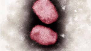 Elektronenmikroskopische Aufnahme von Affenpocken-Viren, koloriert. Foto: Andrea Männel/Andrea Schnartendorff/RKI/dpa